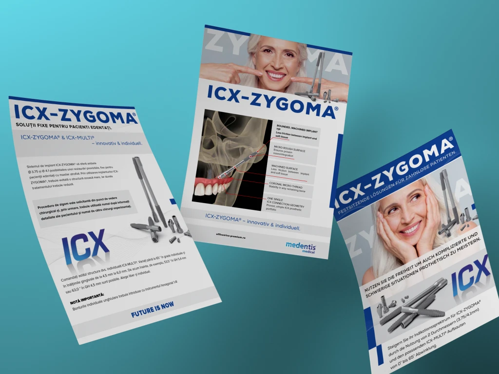 ICX Zygoma